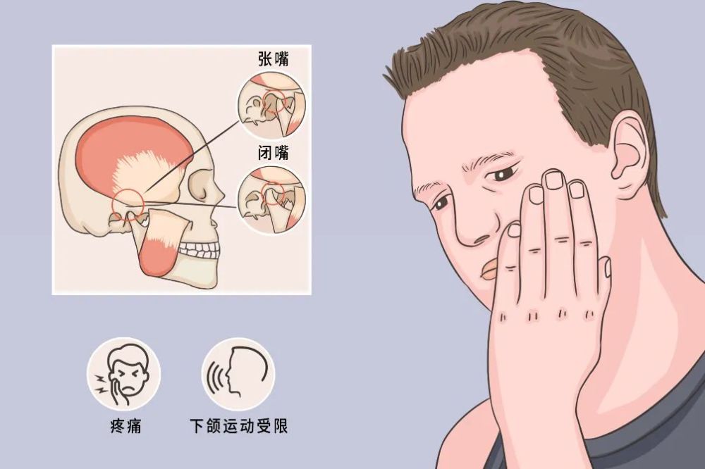 "有口难开"耳鸣"竟是颞下颌关节紊乱综合征_腾讯新闻