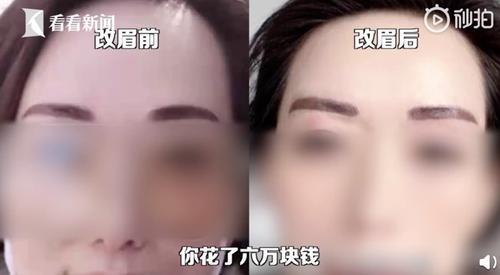 女子纹风水眉被纹成两把大刀,卫生主管部门已介入调查