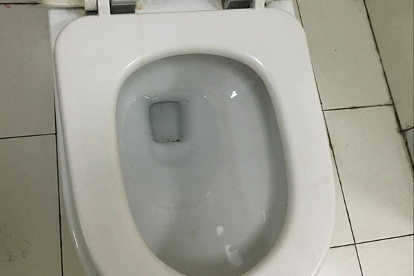 女性在蹲马桶时有必要垫上卫生纸吗别瞎猜医生做出解答