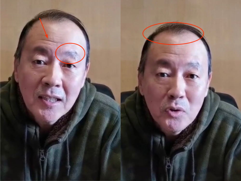 63岁老戏骨侯天来罕露面,毛发稀疏变化大,身后墙板掉漆物品乱