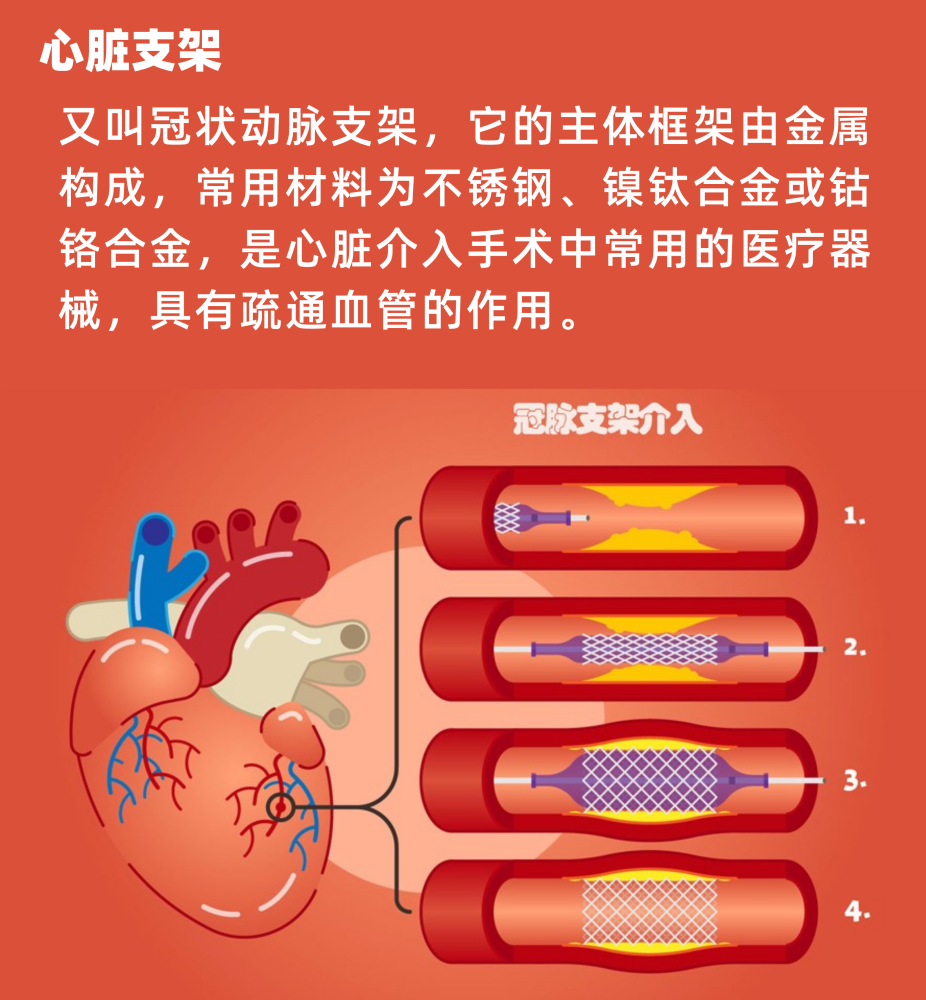 华西医院杨庆心脏支架会给我们的身体带来什么影响