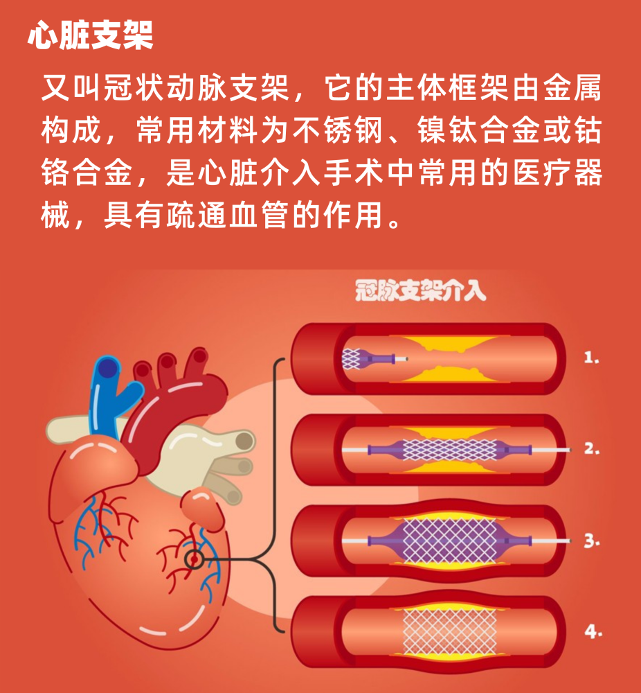 华西医院杨庆:心脏支架会给我们的身体带来什么影响?