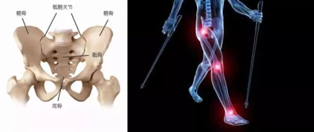 沈阳京城强直医院谈:强直性脊柱炎一定是从骶髂关节开始发病吗?