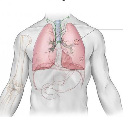 肺癌的早期症状和前兆有哪些