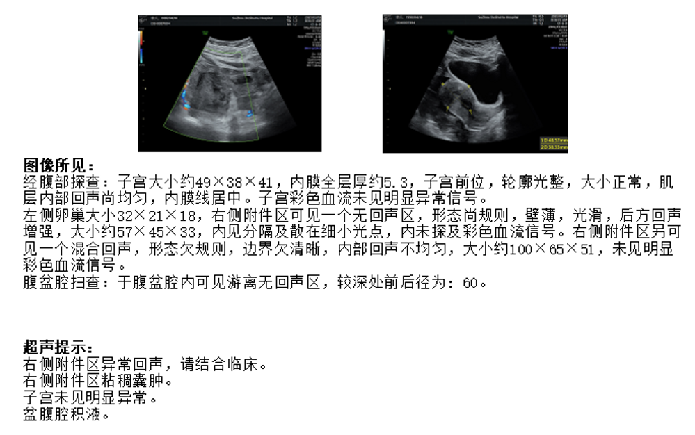 30岁女性腹腔内出血约2000ml排除异位妊娠还有什么可能