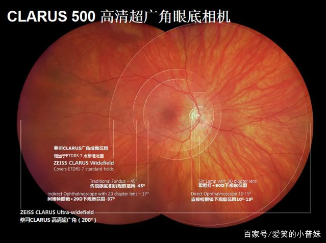 普瑞眼科眼底检查神器——蔡司clarus 500高清超广角眼底相机