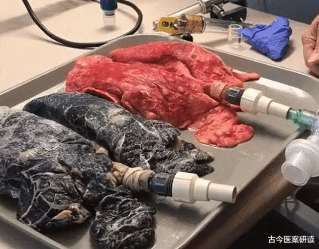 尼古丁克星已发现放开喝润肺排毒给肺部做个大扫除