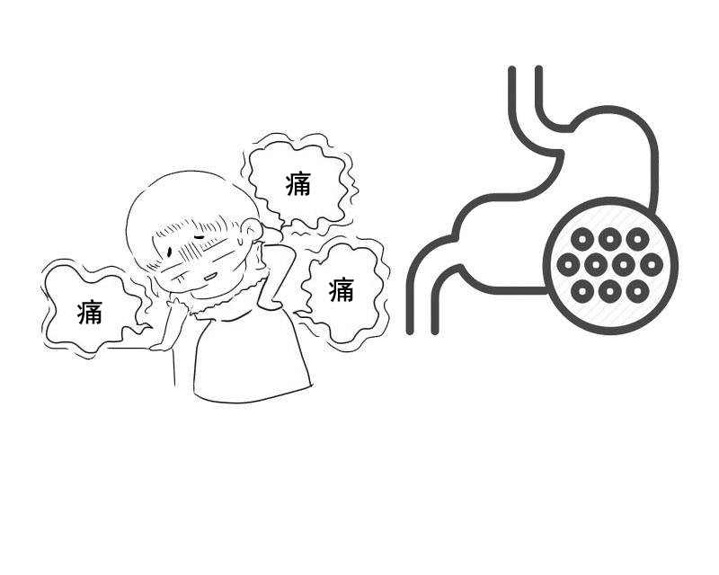 国际护胃日:胃病患者要注意!若反复出现3种现象,请及时做胃镜