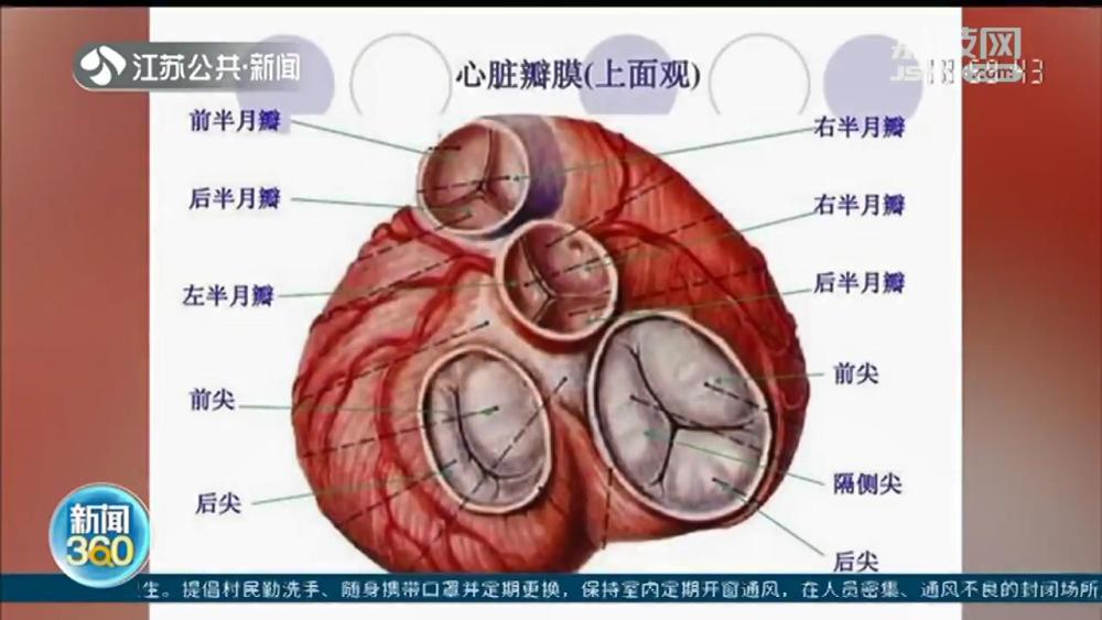 心脏瓣膜病治疗可以不动"大刀"了 手术切口仅6毫米左右