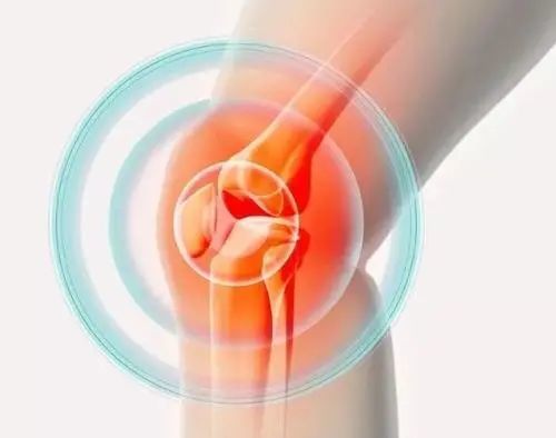 滑膜炎是一种多发性疾病,其病发部位主要在人体滑膜最多的膝关节.