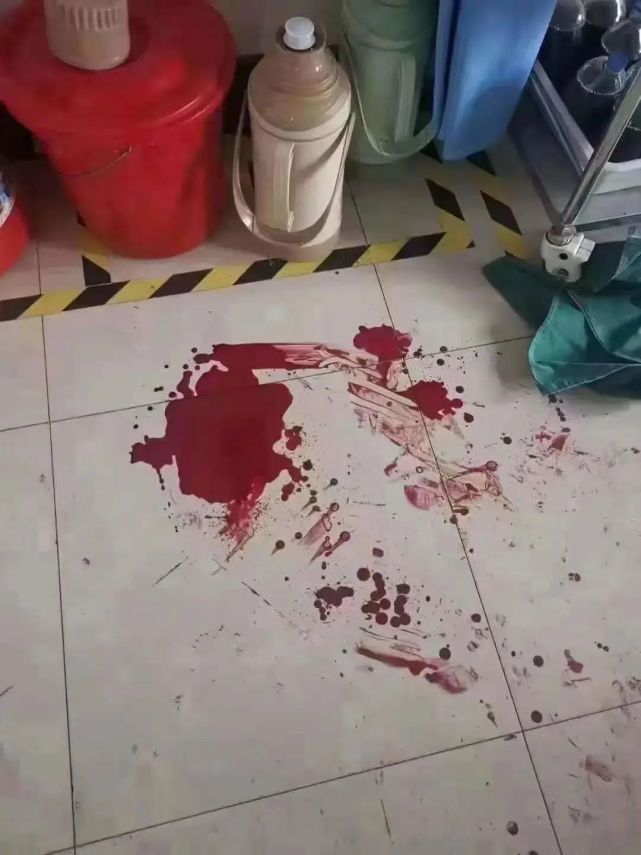 一医院急诊科多名医生被打伤:行凶者下手狠辣,招招致命,满地是血!
