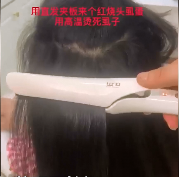 梅州10岁女孩染头虱,各种方法去不掉,妈妈热