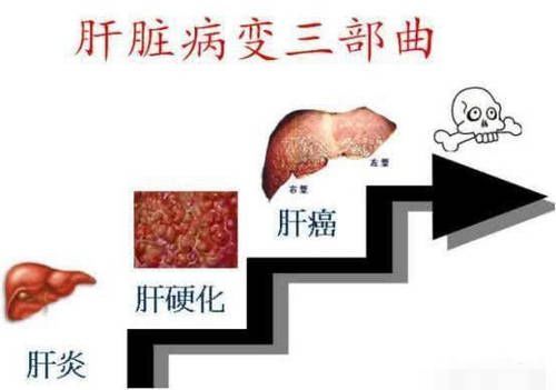 癌症之王胰腺癌还是肝癌?哪种癌症死亡率高?医生告诉你答案