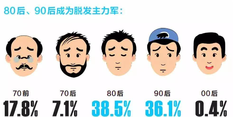 雄激素性脱发是男人专利吗?