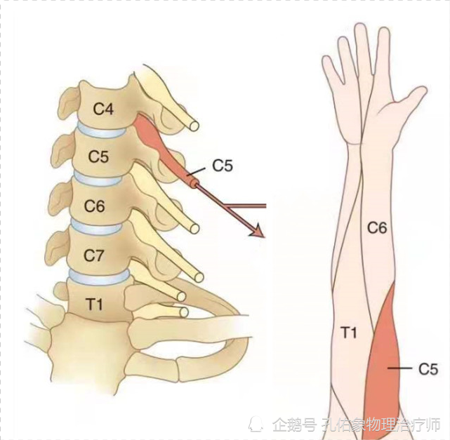 因为支配我们整个上肢的运动和感觉的神经都是从颈椎发出来的,一旦