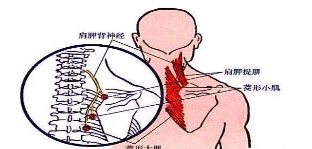 斜方肌上部起始与枕外隆凸及上项线,抵止于锁背外1/3肩峰及肩胛冈