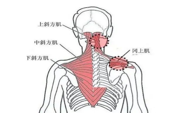 详解颈部肌筋膜性疼痛