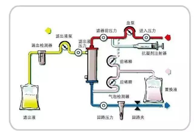 关于icu里的crrt,您了解多少?