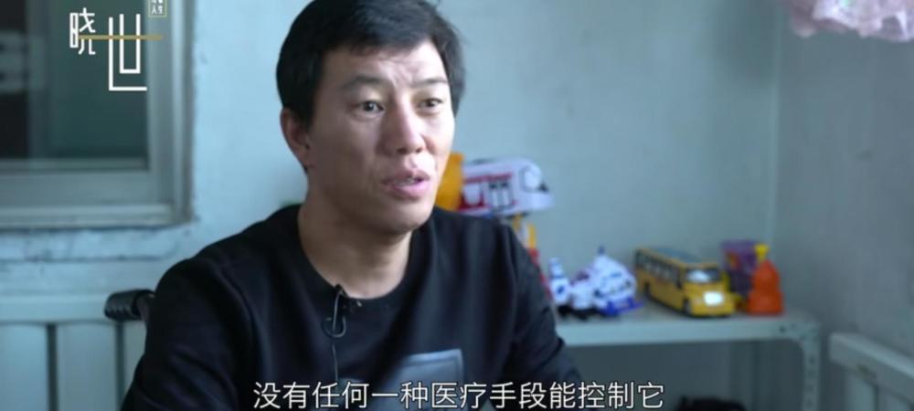 截肢再截肢,医生断言他活不过30岁,死前留遗言:核辐射,没有药