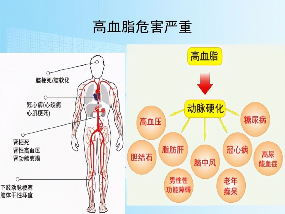 高血脂患者和心血管专家门诊对话!从中可以学习到如何