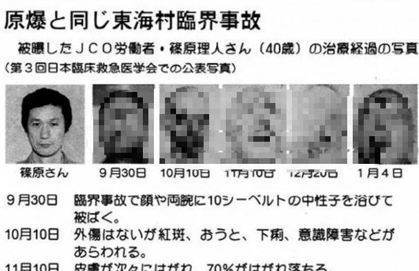 83天一个壮汉变成一堆腐肉核辐射惨烈堪比十八层地狱