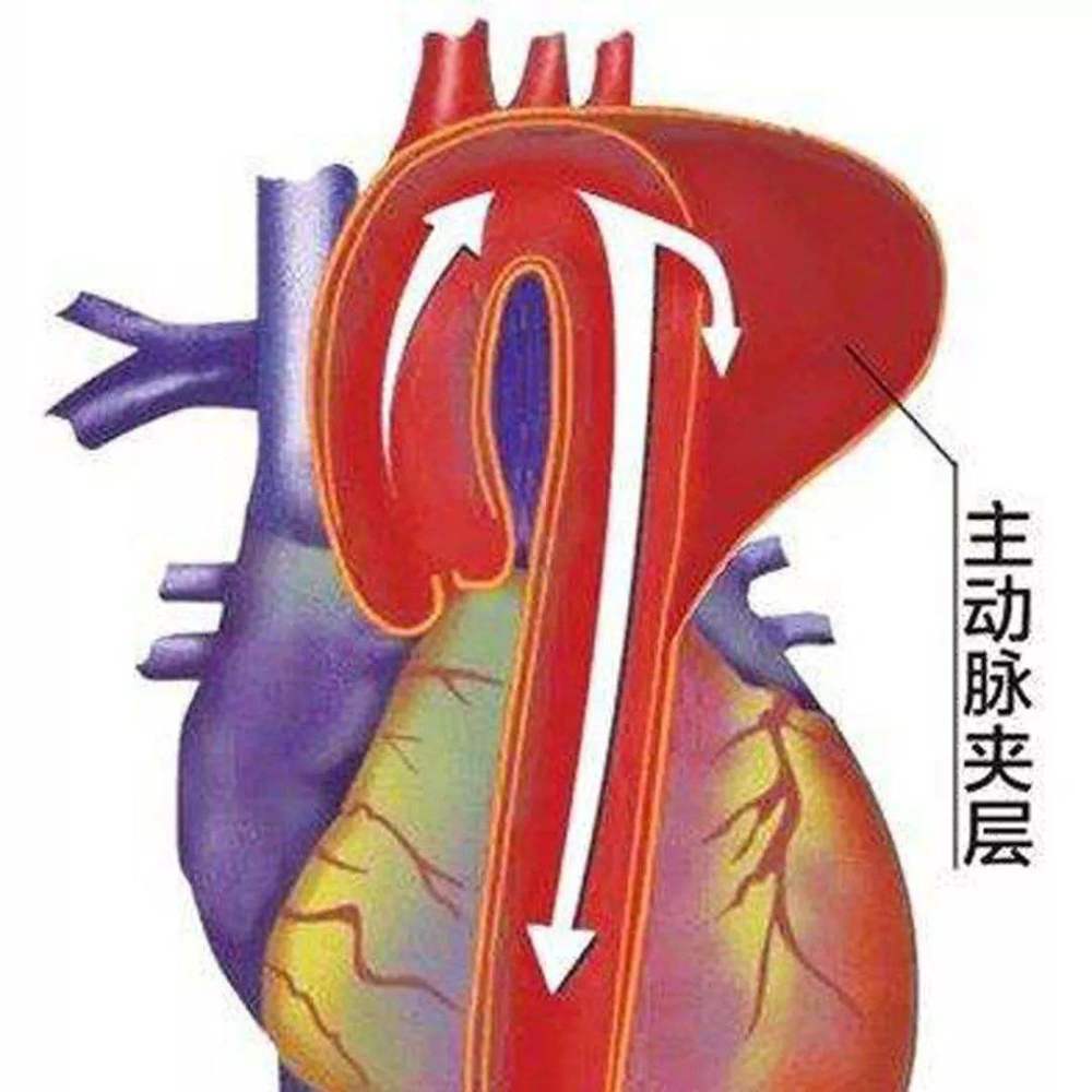 不是只有心肌缺血才会胸痛,这12种常见疾病也会引起胸痛