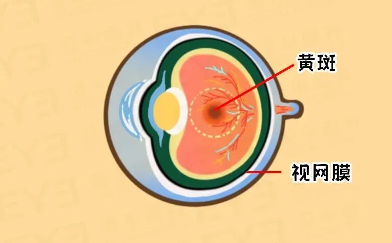 黄斑是视网膜上一处无血管凹陷区位于视网膜内面正对视轴处是视网膜上