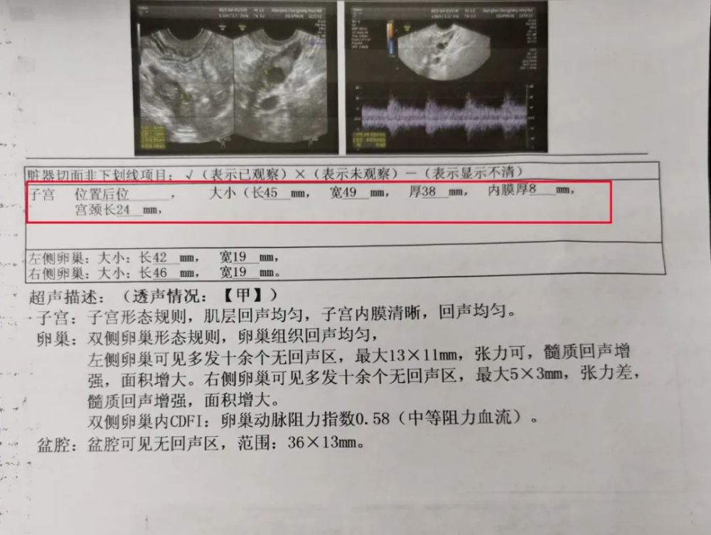 正常子宫的5个硬指标可