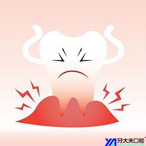 牙龈肿痛怎么办
