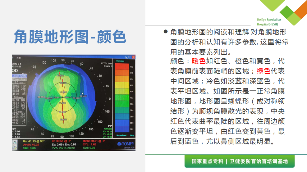 角膜地形图在塑形镜中的数据解读