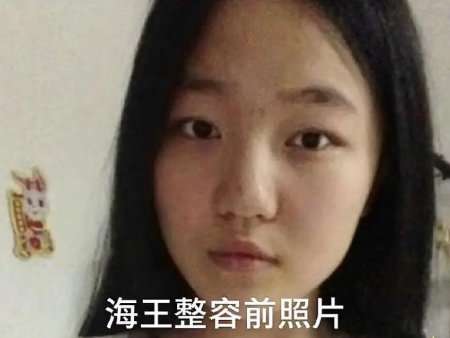 "女海王"项思醒旧照被扒,整容效果堪比换头,网友:人心