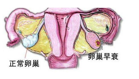 女性卵巢早衰吃什么调理