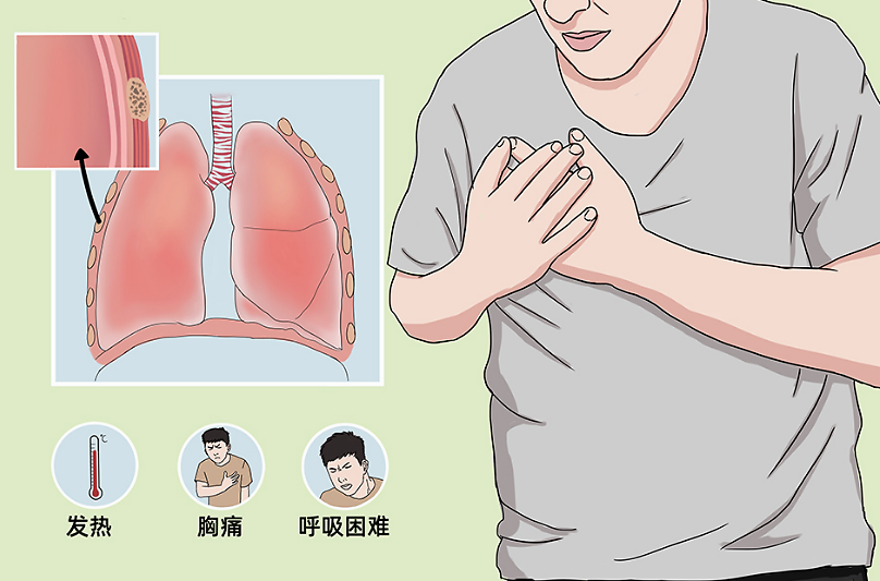 大学生提行李爬楼突发胸痛患气胸专家瘦高男生尤要警惕