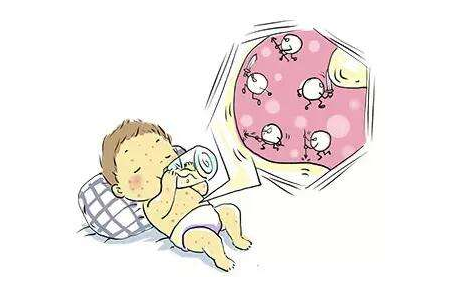 如何治疗宝宝湿疹