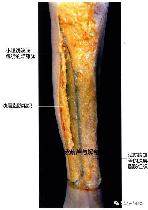 筋膜解剖|下肢浅筋膜