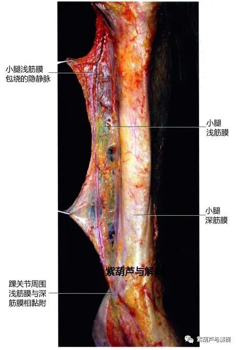 筋膜解剖下肢浅筋膜