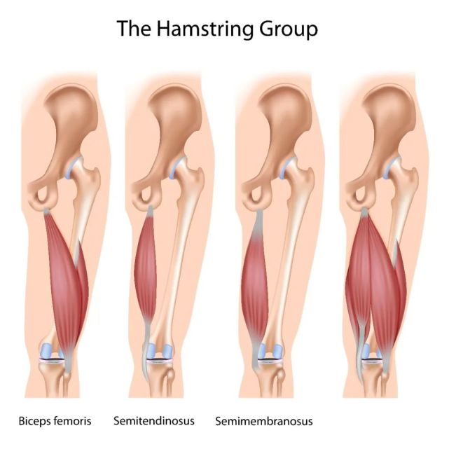 腘绳肌(hamstring)是人体最容易被误解的肌肉之一.