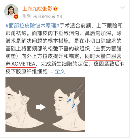 面部拉皮后会有疤痕嘛