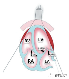 多图片解读超声心动图瓣膜分布,干货满满,快来收藏!