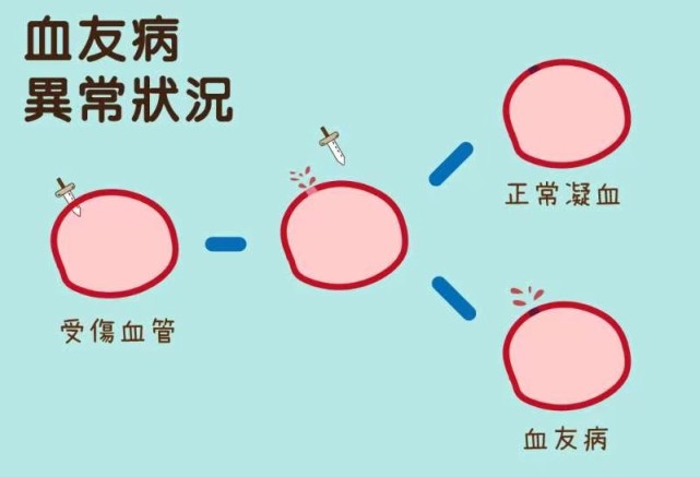 曾经困扰欧洲皇室的血友病为什么绝大部分发生在男性身上