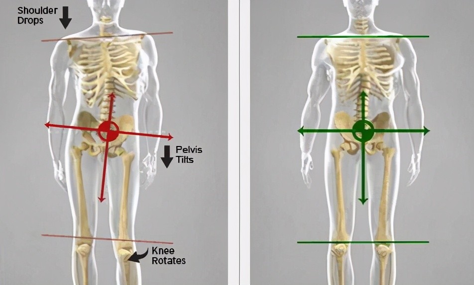 骨盆前倾,后倾,侧倾,旋转,一篇文章全讲解