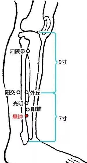 针刺悬钟穴治疗偏头痛