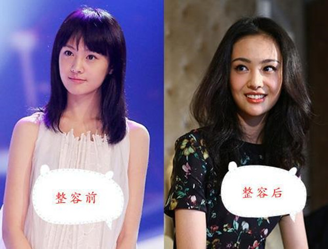 盘点娱乐圈那些整容失败的女明星,明明很美,为何要整?