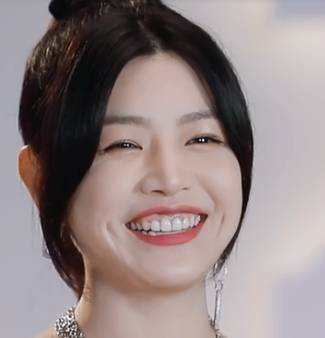 黄小蕾吐槽烤瓷牙整成满口烤瓷牙的女星还有谁