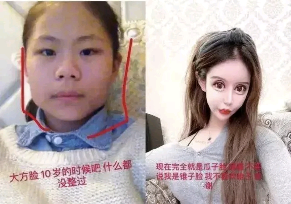 16岁的网红女孩娜娜想要整容,却被多家整容医院拒绝,这是为什么呢?