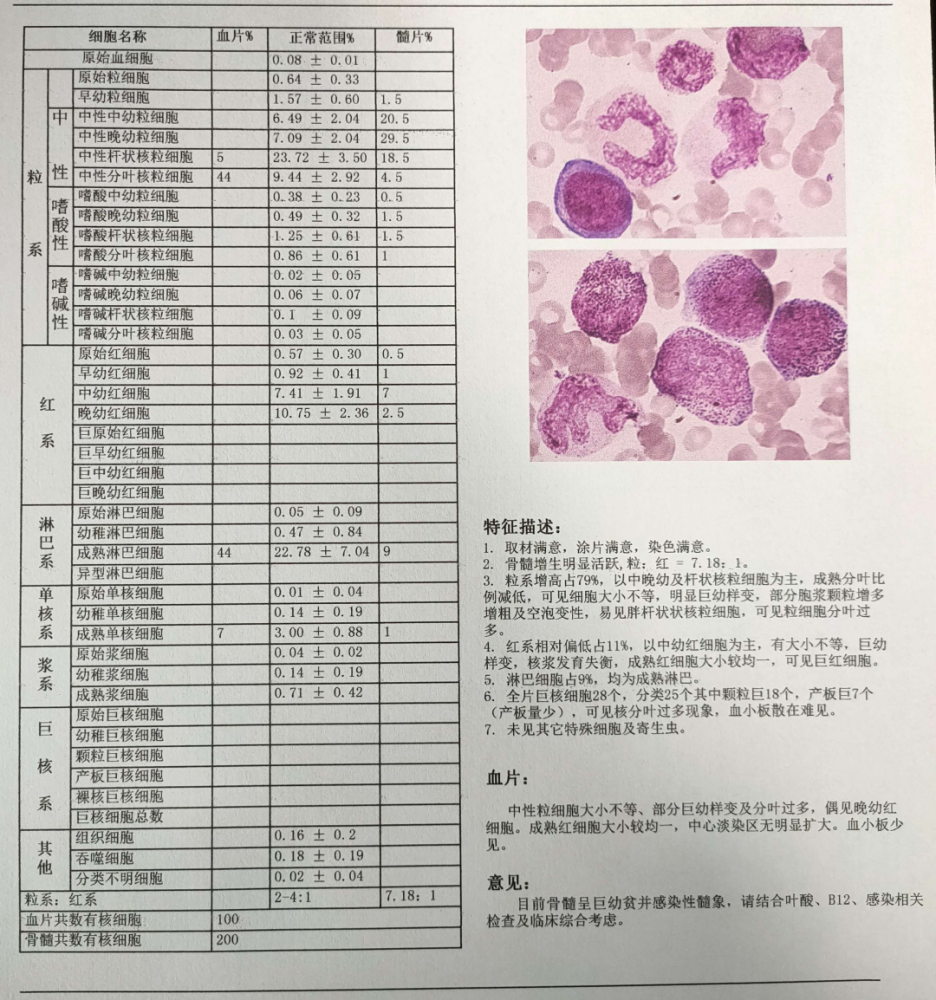 一例妊娠合并巨幼细胞贫血病例分享