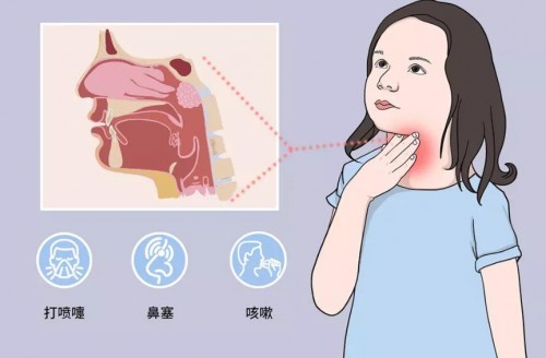 孩子上呼吸道感染,别乱用药!不同抗生素用药方案,收好