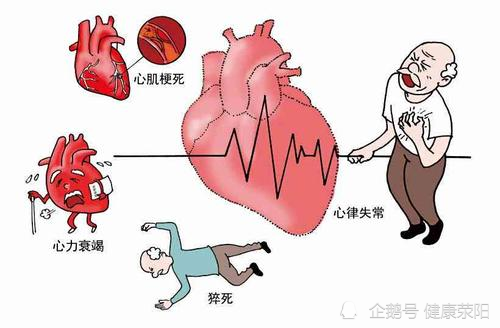 健康荥阳:冠心病的症状及预防控制