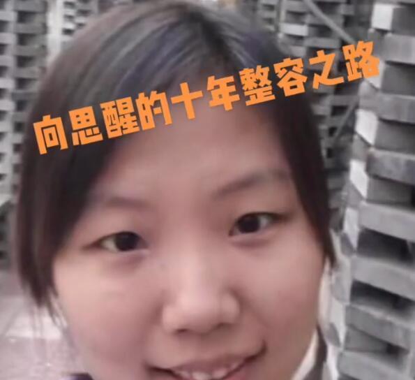 网红项思醒众多旧照曝光整容之前就是一个普通素人