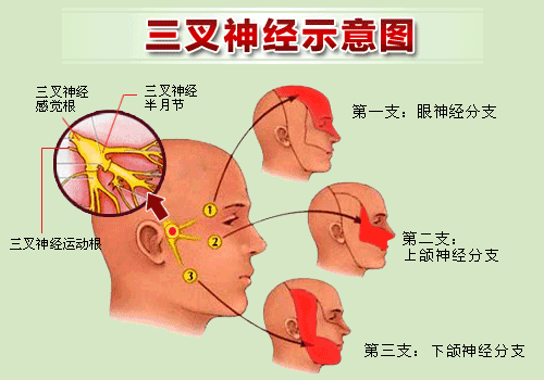 郴州市民有福了不到1小时解决了困扰他30多年的三叉神经痛